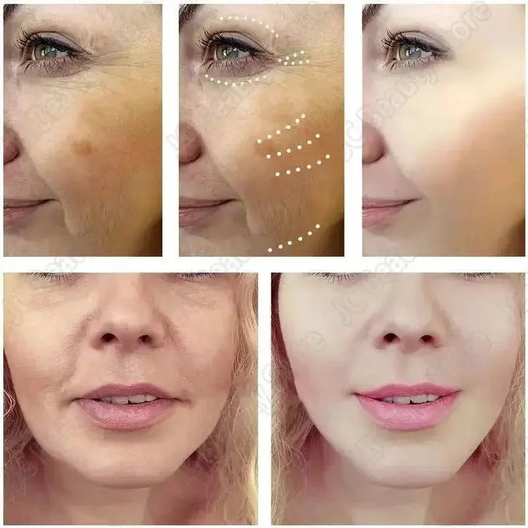 Whitening Capsules Tightening Capsules Anti-Aging Skin Care by Dropshee